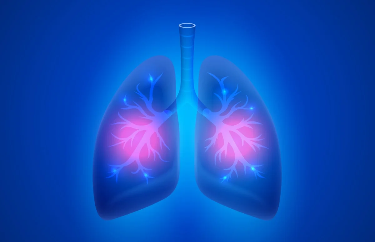 ESMO 2026: Sanovo Data Bolsters First-Line Orpathys in Specific NSCLC Subgroups, Though Adverse Events Temper Clinical Enthusiasm